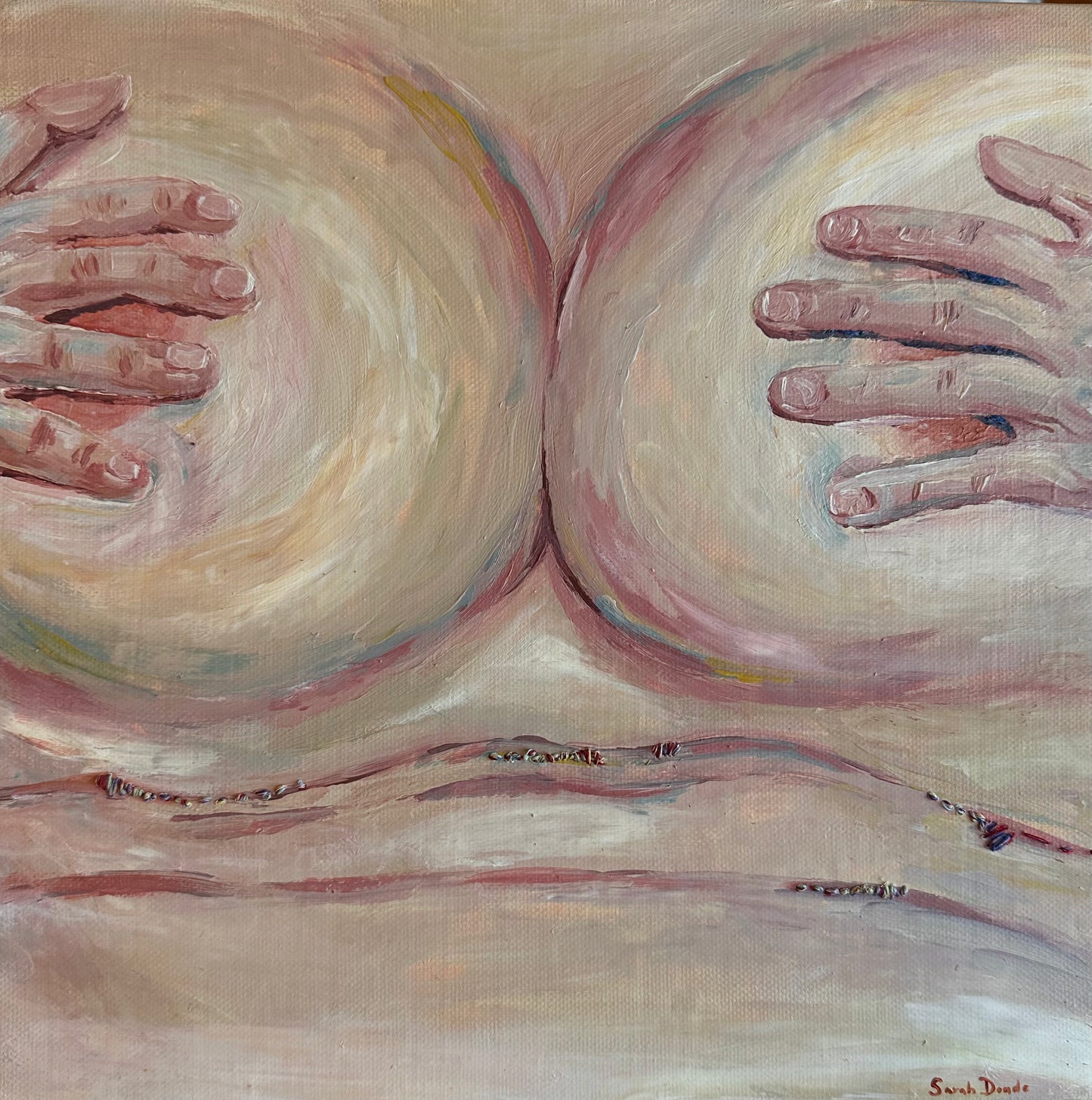 Undesired Lines: Breast strokes